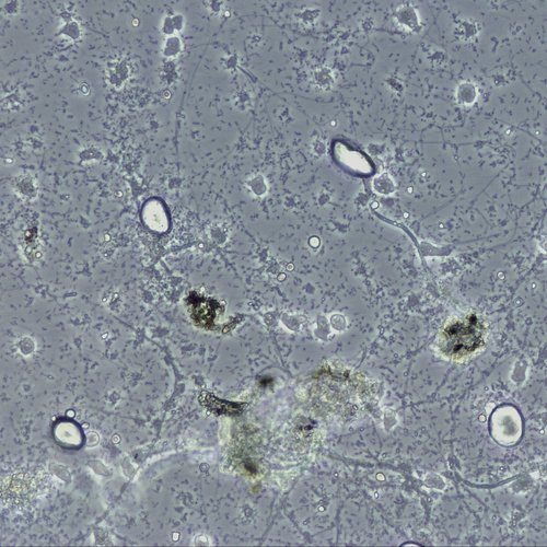 Amoeba swim around under a microscope